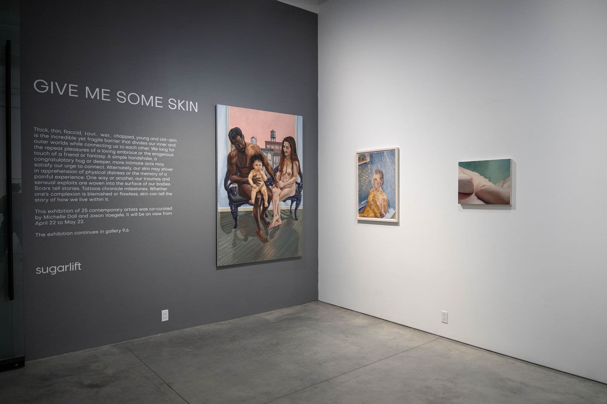 Give Me Some Skin, installation view