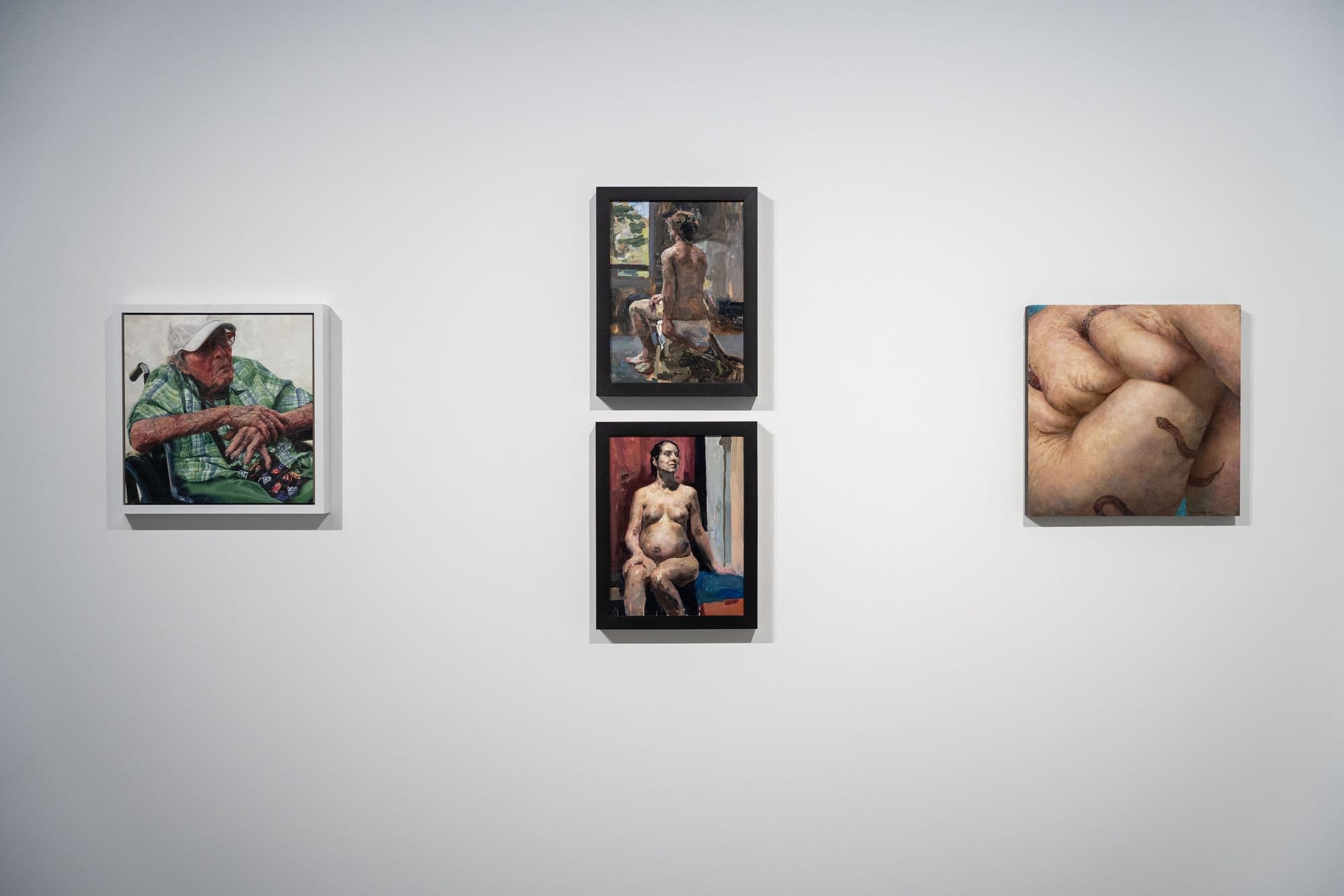 Give Me Some Skin, installation view